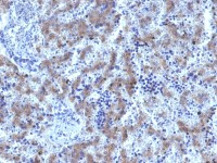 Glypican-3 antibody [GPC3/1534R]