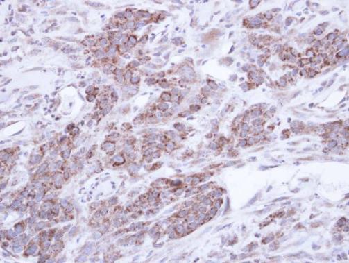 Abin 2 antibody [N1C2]