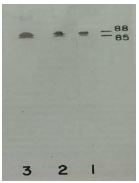 Plasma Kallikrein 1B antibody [13G11]