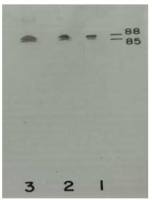 Plasma Kallikrein 1B antibody [13G11]