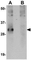 SYPL2 antibody