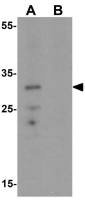 C/EBP delta antibody