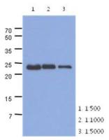 TNNI1 antibody [AT36E7]