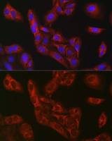 FBP1 antibody