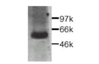 CTGF antibody