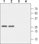 Cav gamma 5 antibody