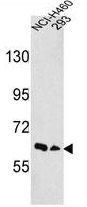 EphA3 antibody, N-term