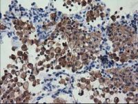 FAM84B antibody [4A4]