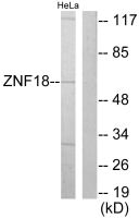 ZNF18 antibody