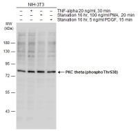 PKC theta (phospho Thr538) antibody