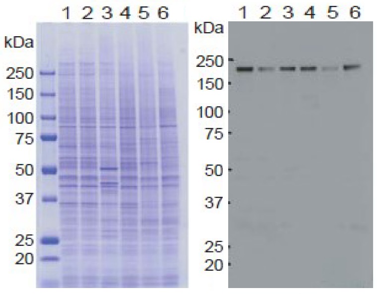 KDM5A / Jarid1A / RBBP2 antibody [18E8]