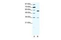 GDI1 antibody, C-term