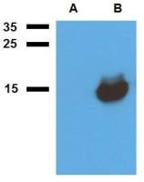 Mycobacterium tuberculosis Acr1 antibody [PAb (185)]