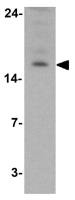 LAMTOR2 antibody