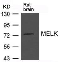MELK antibody