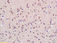 ASH1L antibody