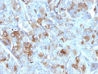 Chromogranin A antibody [CHGA/777]