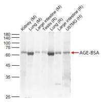 AGEs antibody