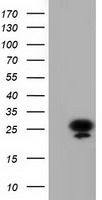 AK3 antibody [6B7]