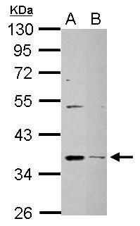 DHRS9 antibody [N1C3]