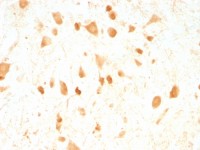 PGP9.5 antibody [UCHL1/775]