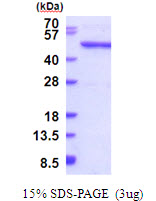 Human QTRTD1 protein, His tag