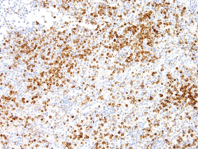 Annexin A1 antibody [IHC512]