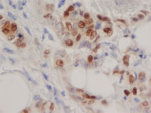 Progesterone Receptor antibody [1A6]