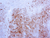 Melan A antibody [A103]