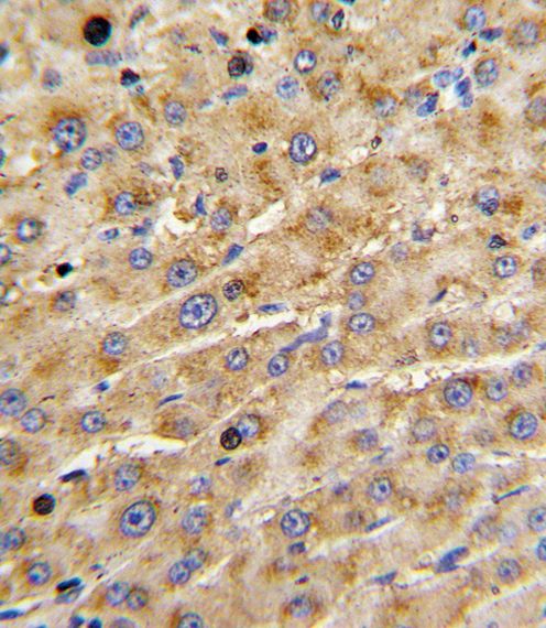 ADAMTS13 antibody, Internal
