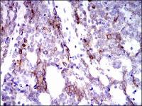 Cytokeratin 5 antibody [10C11E6]