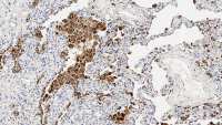 Napsin A antibody [IP64]