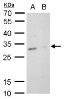 TPPP antibody [N1C3]