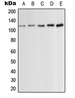 PKC mu (phospho Ser910) antibody