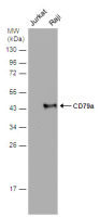 CD79a antibody