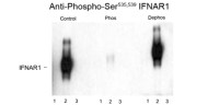 IFNAR1 (phospho Ser535/Ser539) antibody