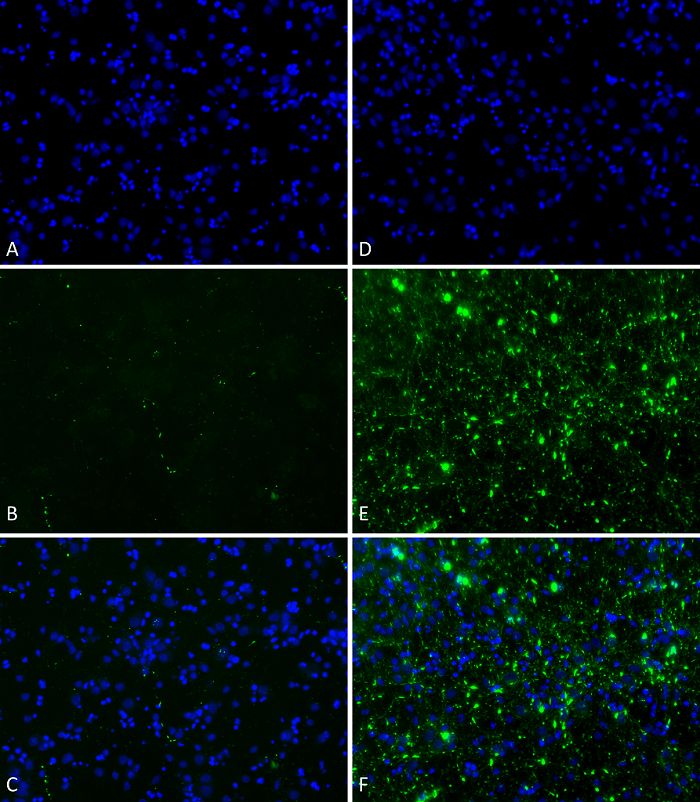 Human alpha Synuclein protein (Pre-Formed Fibrils)
