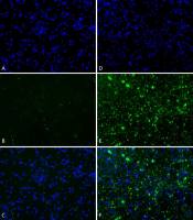 Human alpha Synuclein protein (Pre-Formed Fibrils)