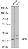 CDX2 antibody