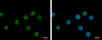 RPL17P7 antibody
