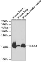 Cardiac Troponin C antibody
