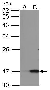 REG III alpha antibody [C1C3]