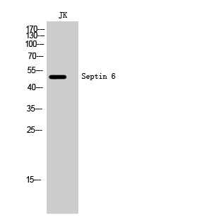 SEPT6 antibody