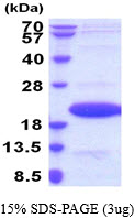 Mouse IL1F6 protein, His tag