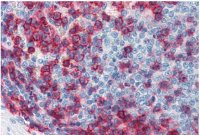 CD43 antibody [MEM-59]