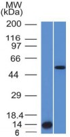 ALK antibody [ALK/1503]