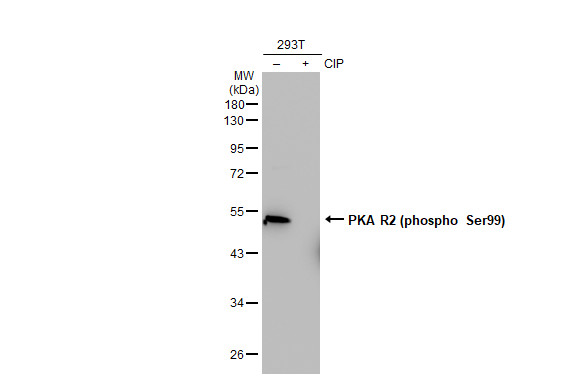 PKA R2 (phospho Ser99) antibody [GT1304]