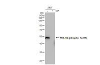 PKA R2 (phospho Ser99) antibody [GT1304]