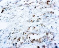 ROS antibody [EPMGHR2]