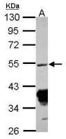 Rxraa+b antibody